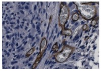 Angiogenese: Spiercellen van een muis en menselijke endotheelcellen tien dagen in vitro gekweekt en daarna 14 dagen in vivo. Er vormen zich vaatachtige structuren.